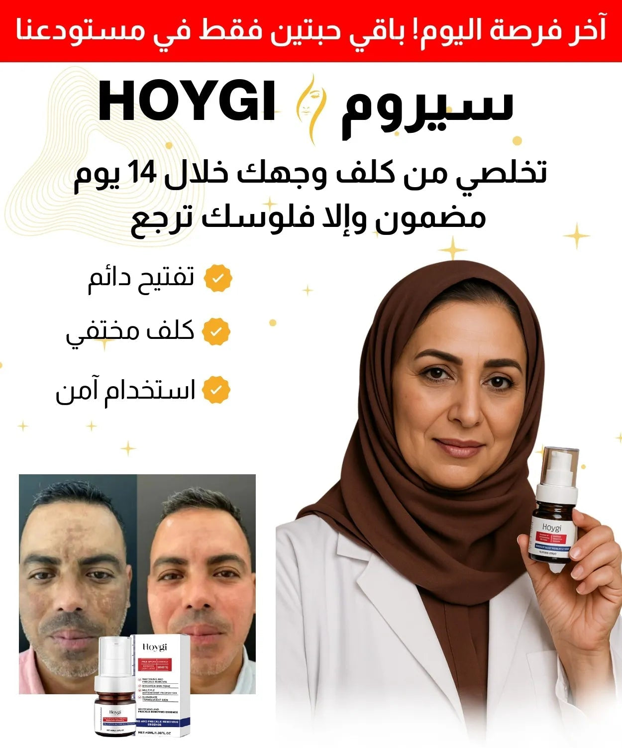 سيروم إزالة الكلف والنمش الأصلي